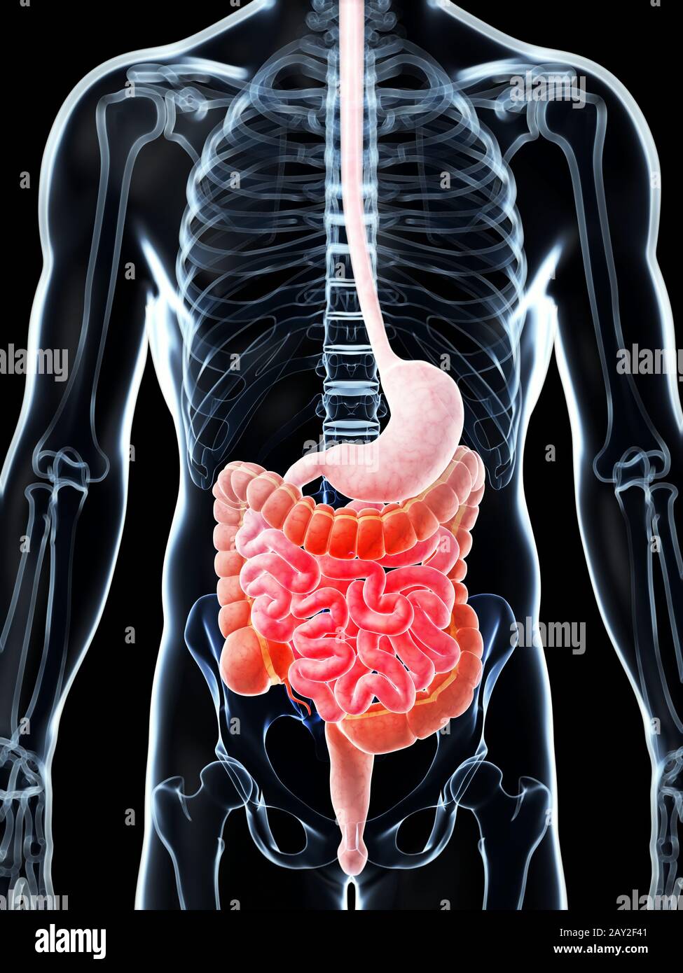 3d reso illustrazione di un doloroso dell' intestino Foto Stock