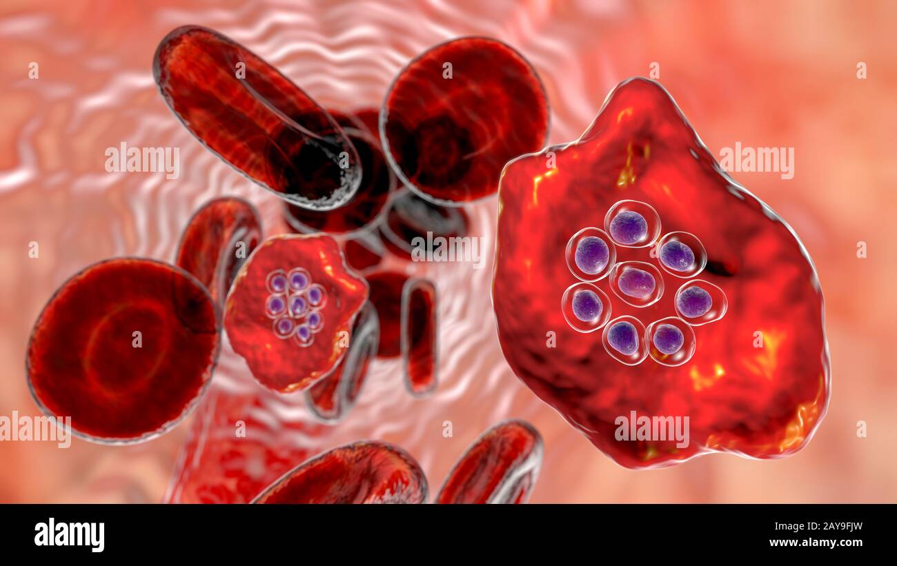 Plasmodium ovale all'interno dei globuli rossi, illustrazione Foto Stock