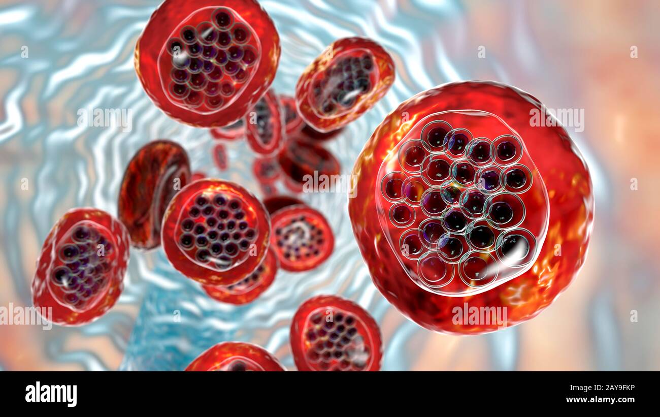 Plasmodium falciparum all'interno dei globuli rossi, illustrazione Foto Stock