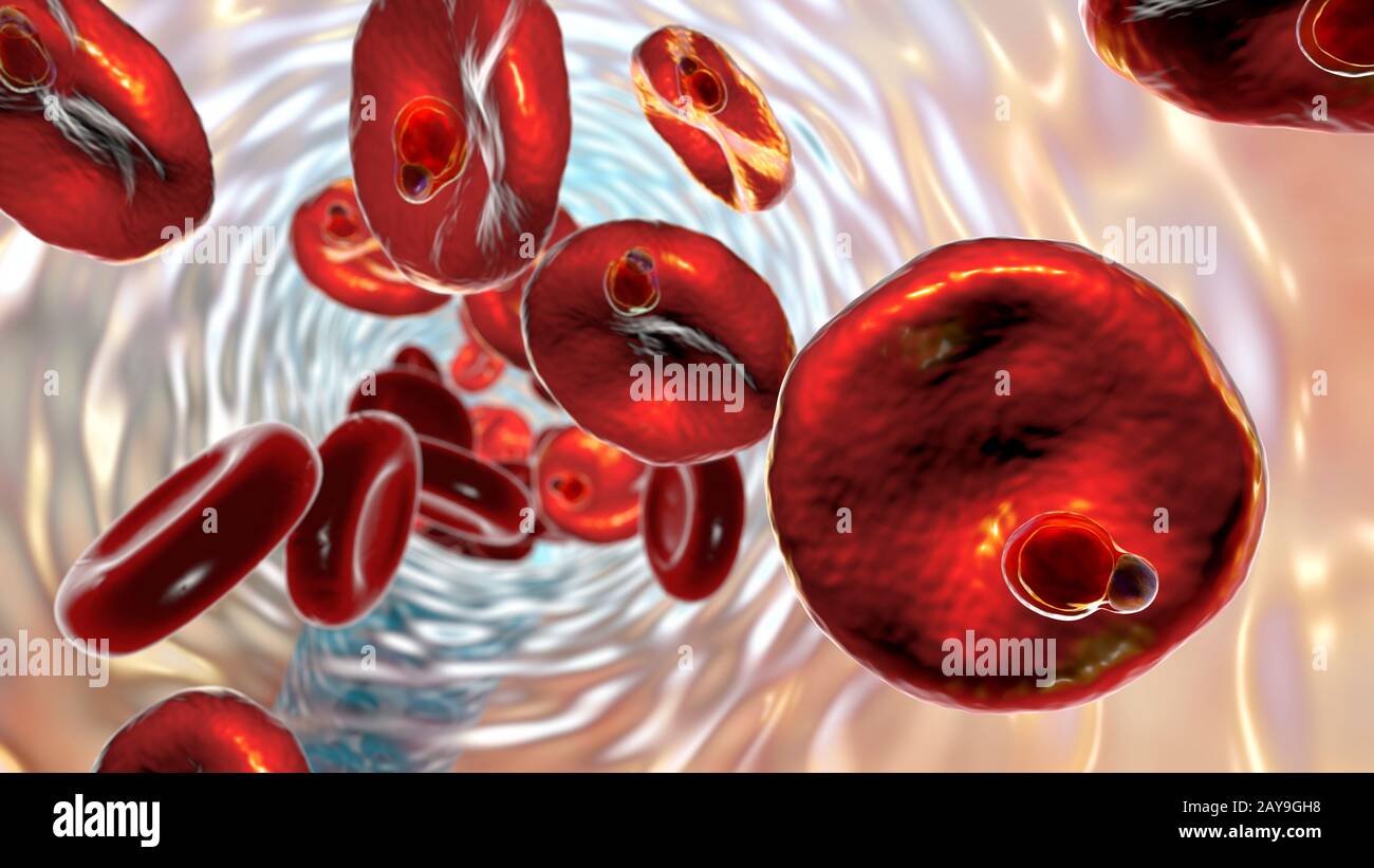 Plasmodium malariae all'interno dei globuli rossi, illustrazione Foto Stock