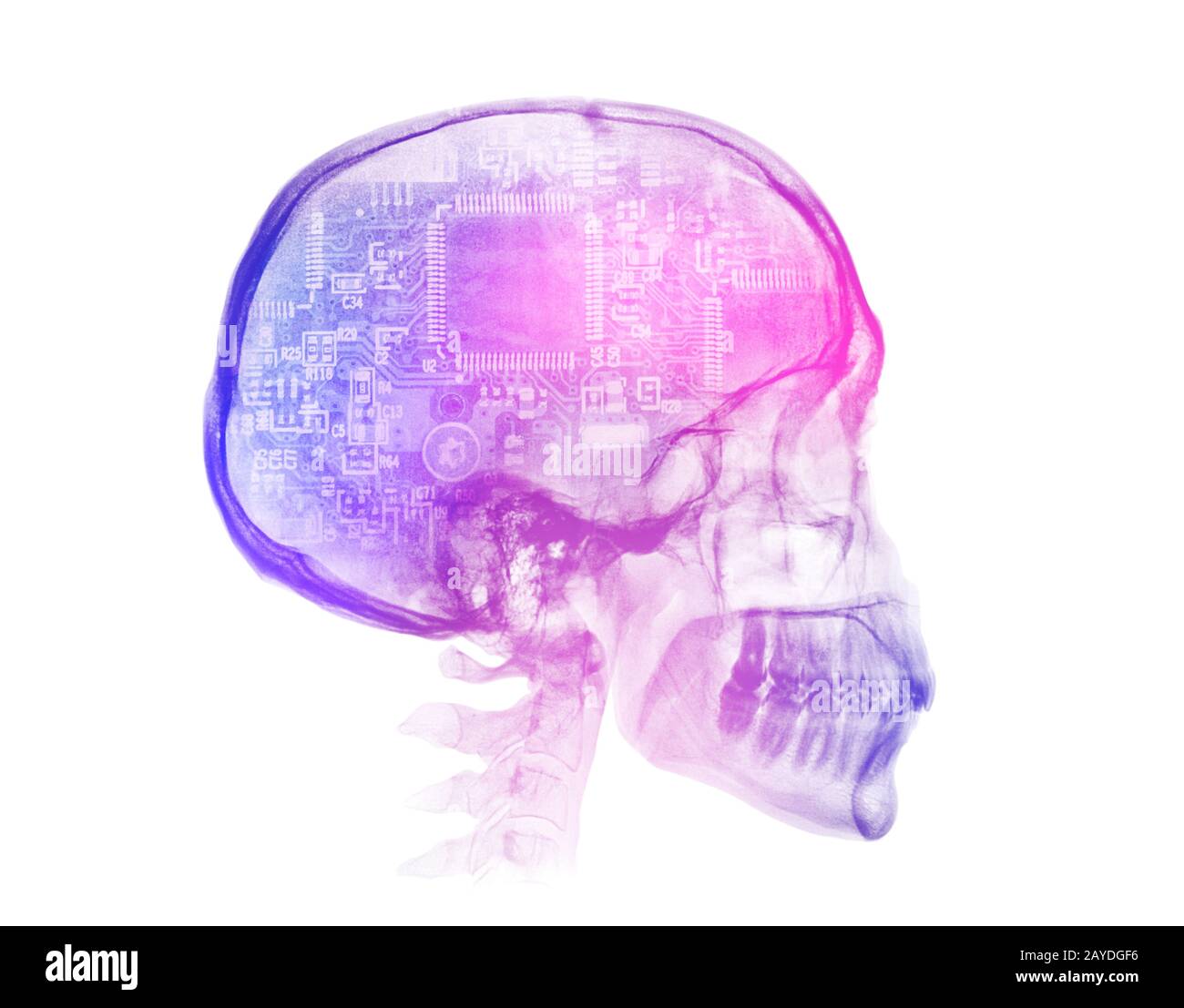 Immagine a raggi X del cranio umano. Concetto di intelligenza artificiale Foto Stock Immagine a raggi X del cranio umano. Concetto di intelligenza artificiale Foto Stock