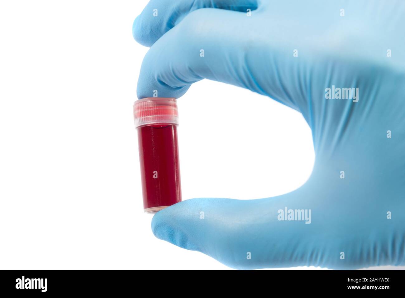Provetta per analisi del sangue in mano al medico, Foto Stock