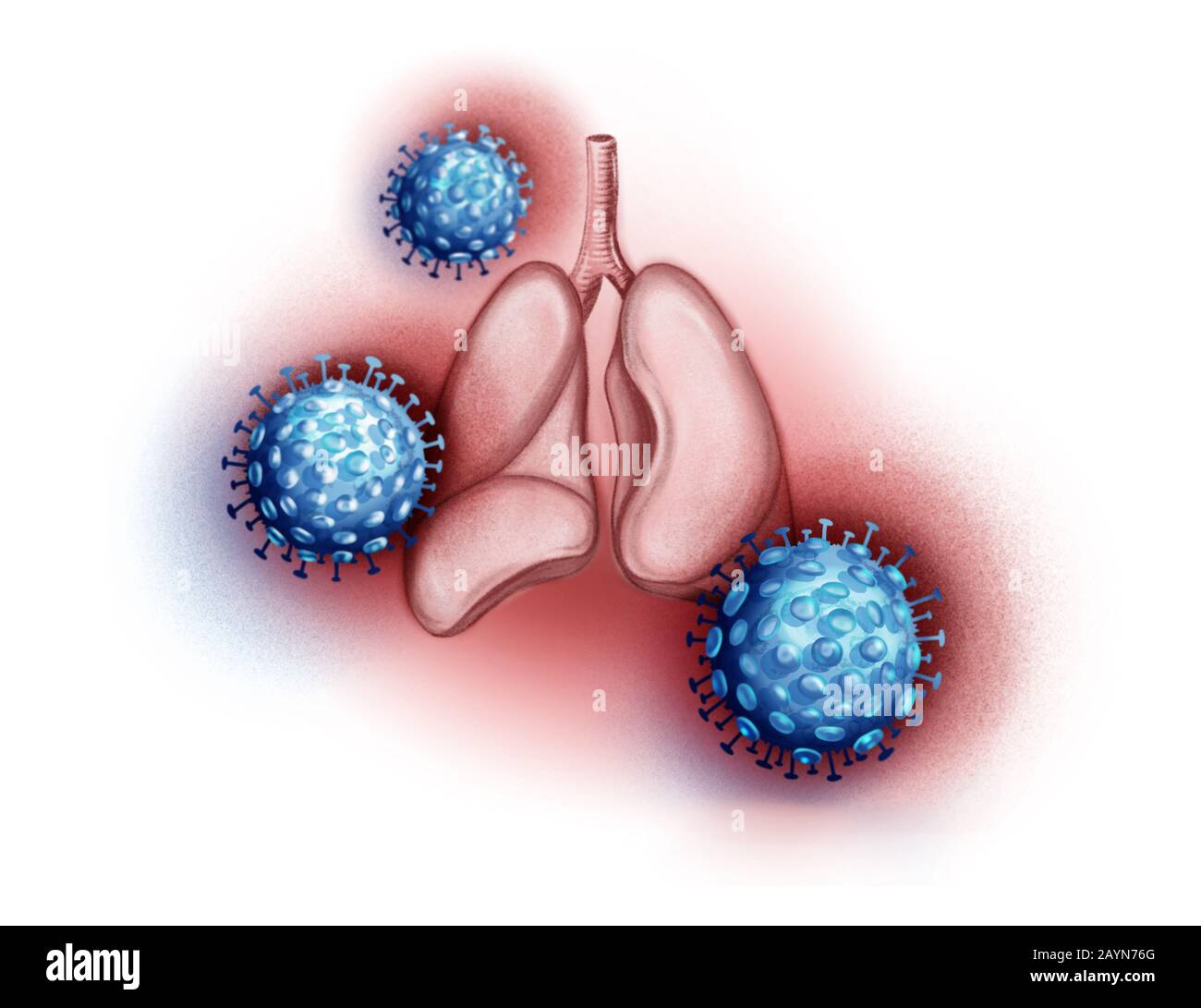 Illustrazione dei polmoni umani e del coronavirus Foto Stock