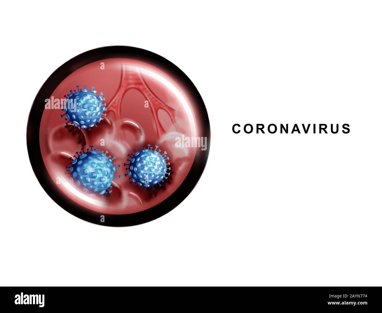 Illustrazione dei polmoni umani e del coronavirus Foto Stock