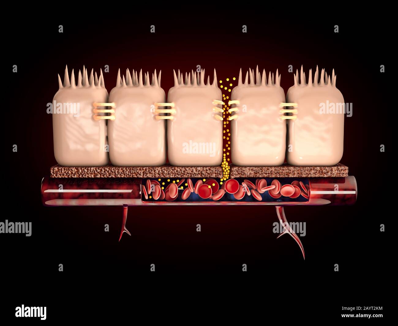3D rappresentazione dell'intestino perverso, nell'intestino con celiaci e sensibilità al glutine queste giunzioni strette si disperdono Foto Stock