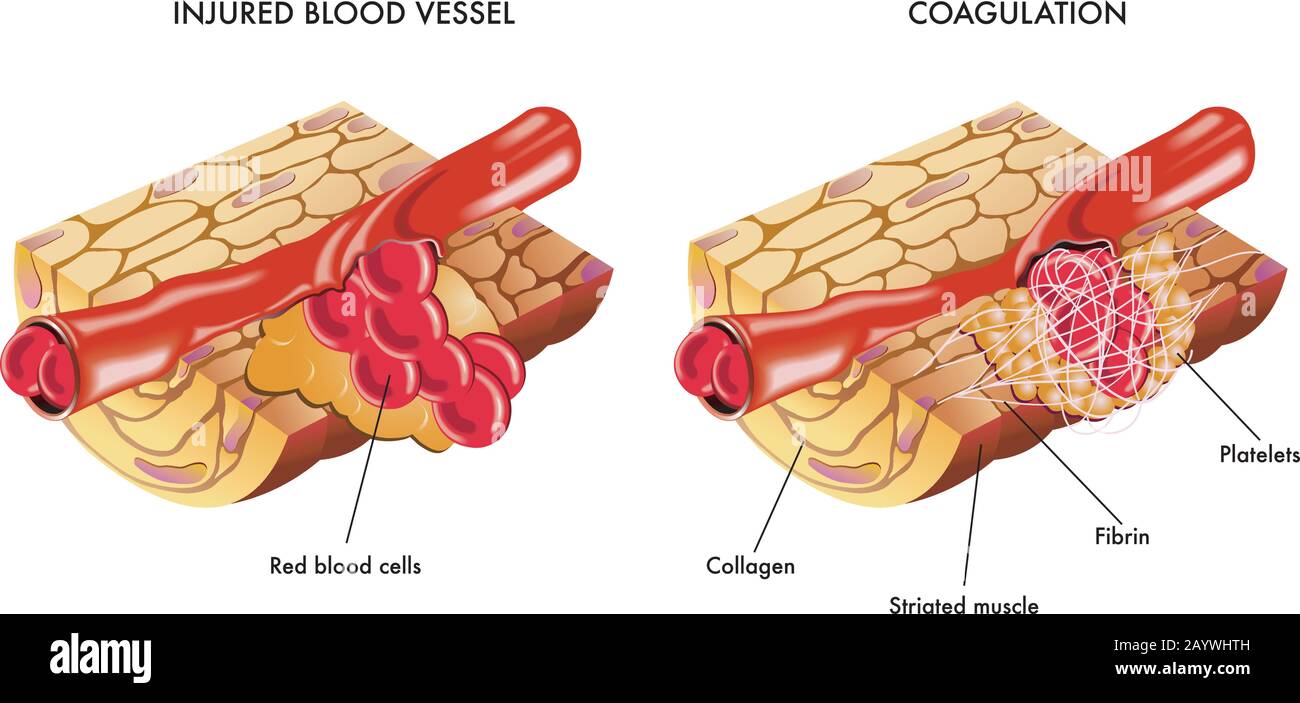 Illustrazione medica del processo di coagulazione del sangue. Illustrazione Vettoriale