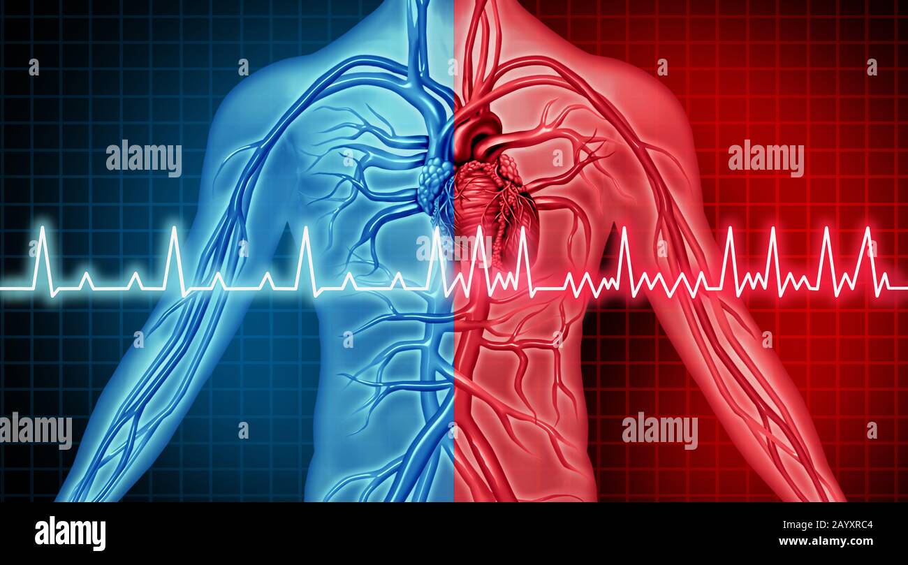 Disturbo della fibrillazione atriale problema cardiaco ed ecg come attacco cardiaco coronarico con ritmo dell'organo irregolare e normale come malattia da fastidio al torace. Foto Stock