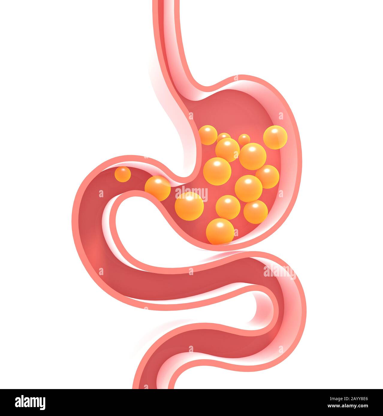3D illustrazione dello schema interno dello stomaco umano con gas. Figura piatta vuota, silhouette isolata su sfondo bianco con colori vivaci Foto Stock