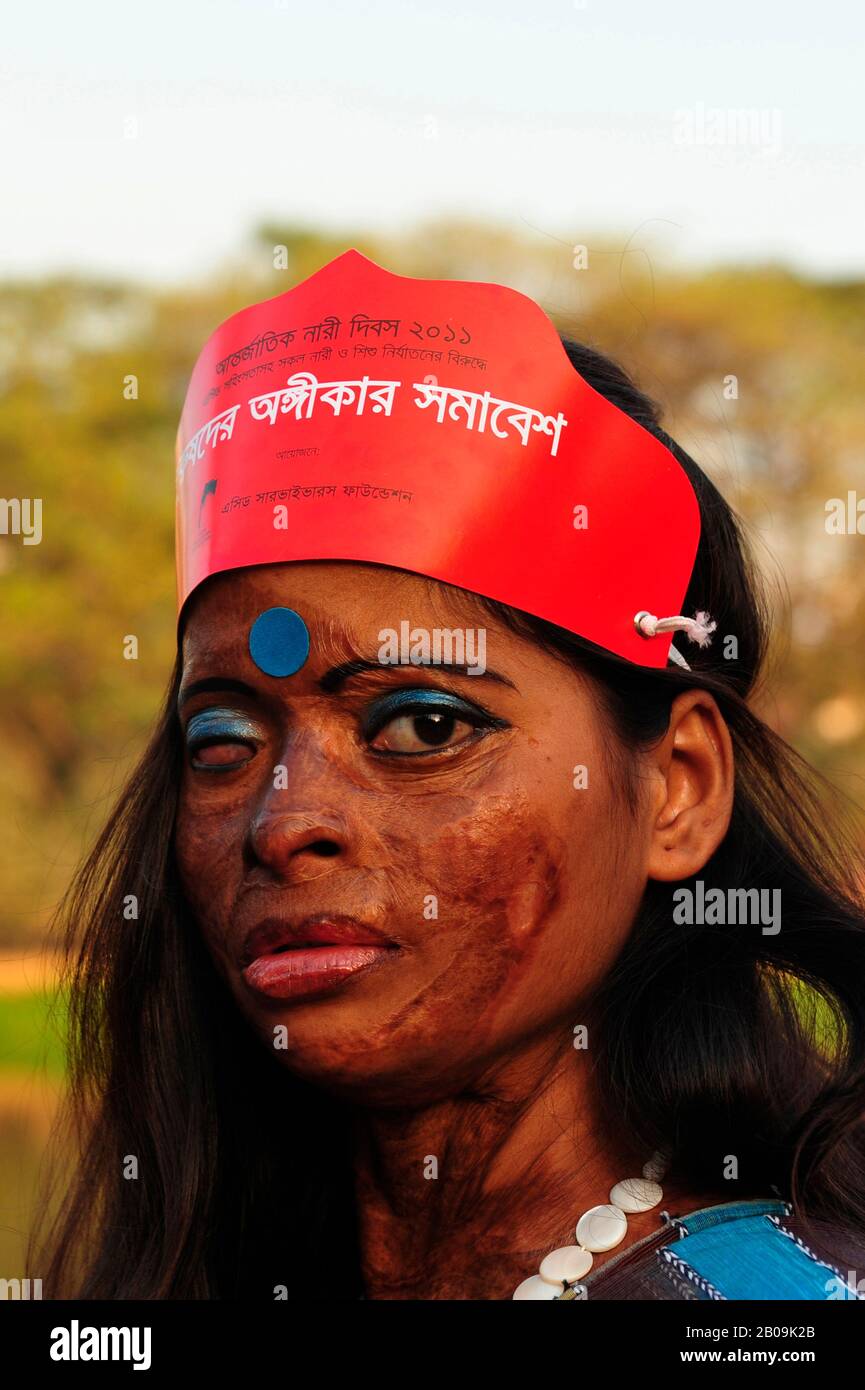 Un sopravvissuto acido partecipa a un programma di sensibilizzazione contro la violenza acida alla vigilia della Giornata internazionale della donna del 2011, a Dhaka, in Bangladesh. 7 Marzo 2011. Foto Stock