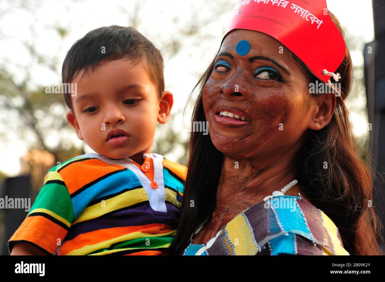 Un sopravvissuto acido partecipa a un programma di sensibilizzazione contro la violenza acida alla vigilia della Giornata internazionale della donna del 2011, a Dhaka, in Bangladesh. 7 Marzo 2011. Foto Stock