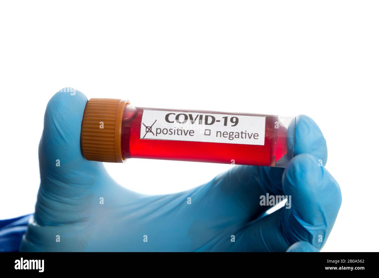 Provetta per analisi del sangue in mano al medico, Foto Stock