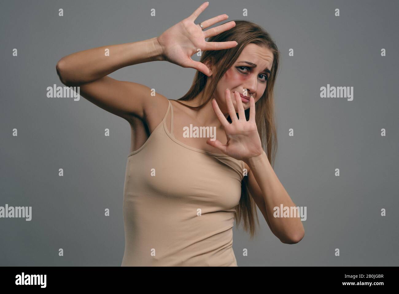 Ragazza bionda con lividi sul suo viso, cercando di proteggersi, posando su sfondo grigio studio. Violenza domestica, abuso. Primo piano, spazio di copia. Foto Stock