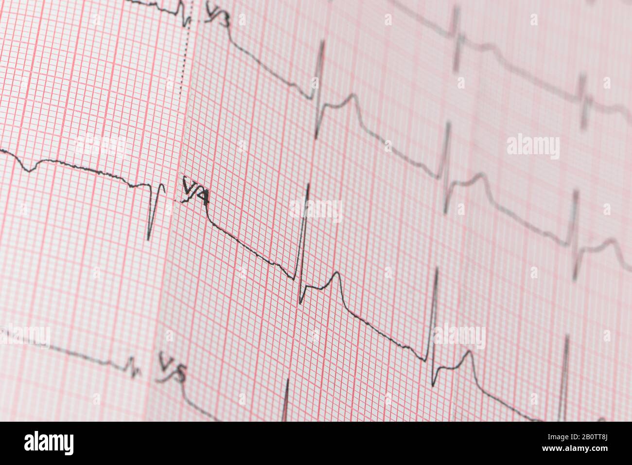 linea reale di un cardiogramma elettrico Foto Stock