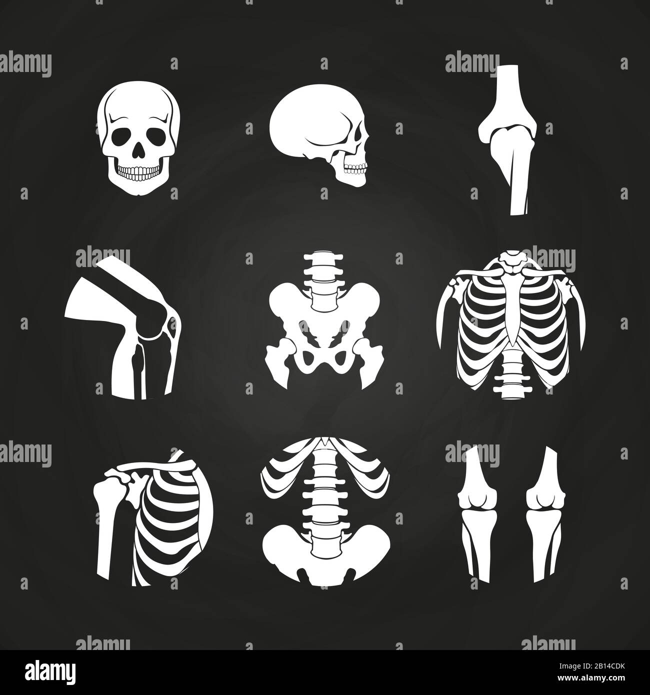 Cranio umano bianco e ossa - diagnostica medica su lavagna. Illustrazione del vettore Illustrazione Vettoriale