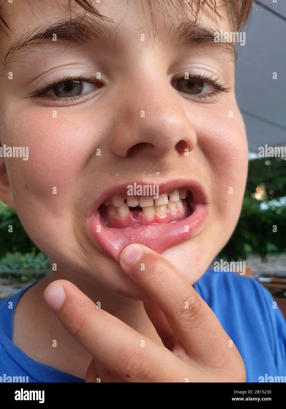 Ragazzo con fessura tra i denti del latte, ritratto, Germania Foto Stock