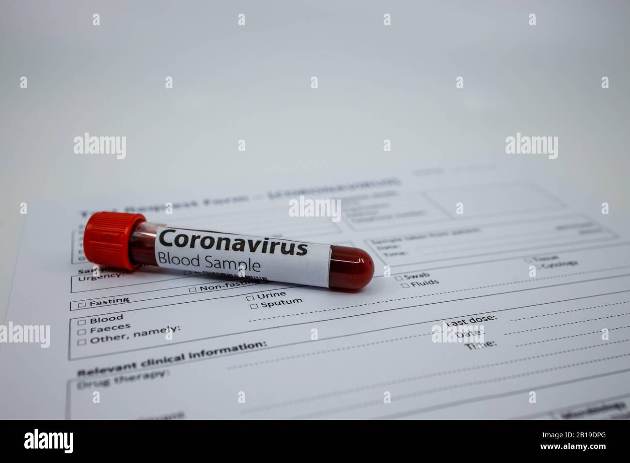 Campione di sangue per il nuovo Coronavirus che si sta diffondendo rapidamente e che ha avuto origine a Wuhan, Cina. Provetta su un modulo di richiesta vuoto per il test del sangue per il covid-19 Foto Stock