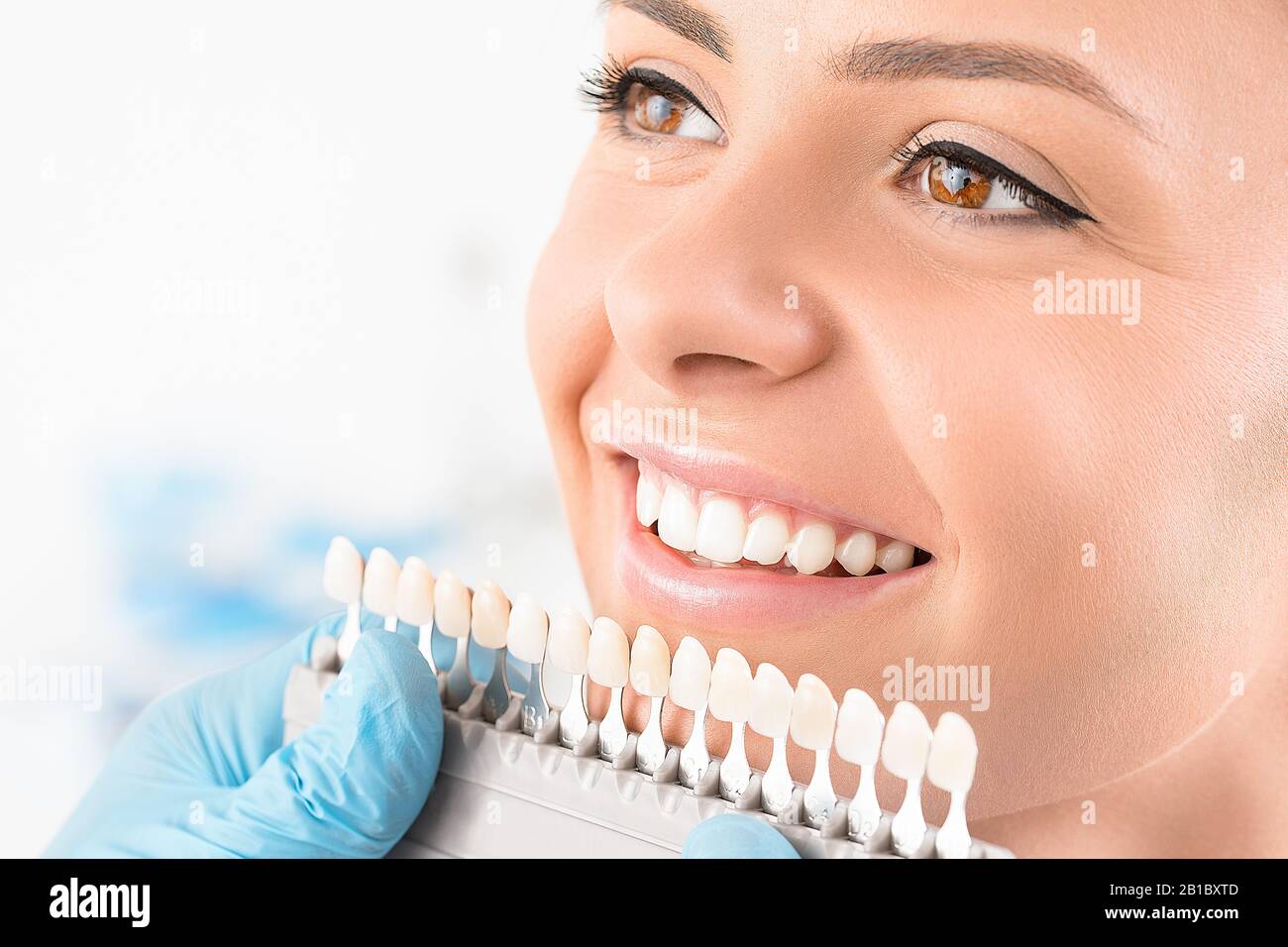 Bel sorriso e denti bianchi di una giovane donna. Matching le sfumature delle protesi mammarie o il processo di sbiancamento dei denti. Foto Stock