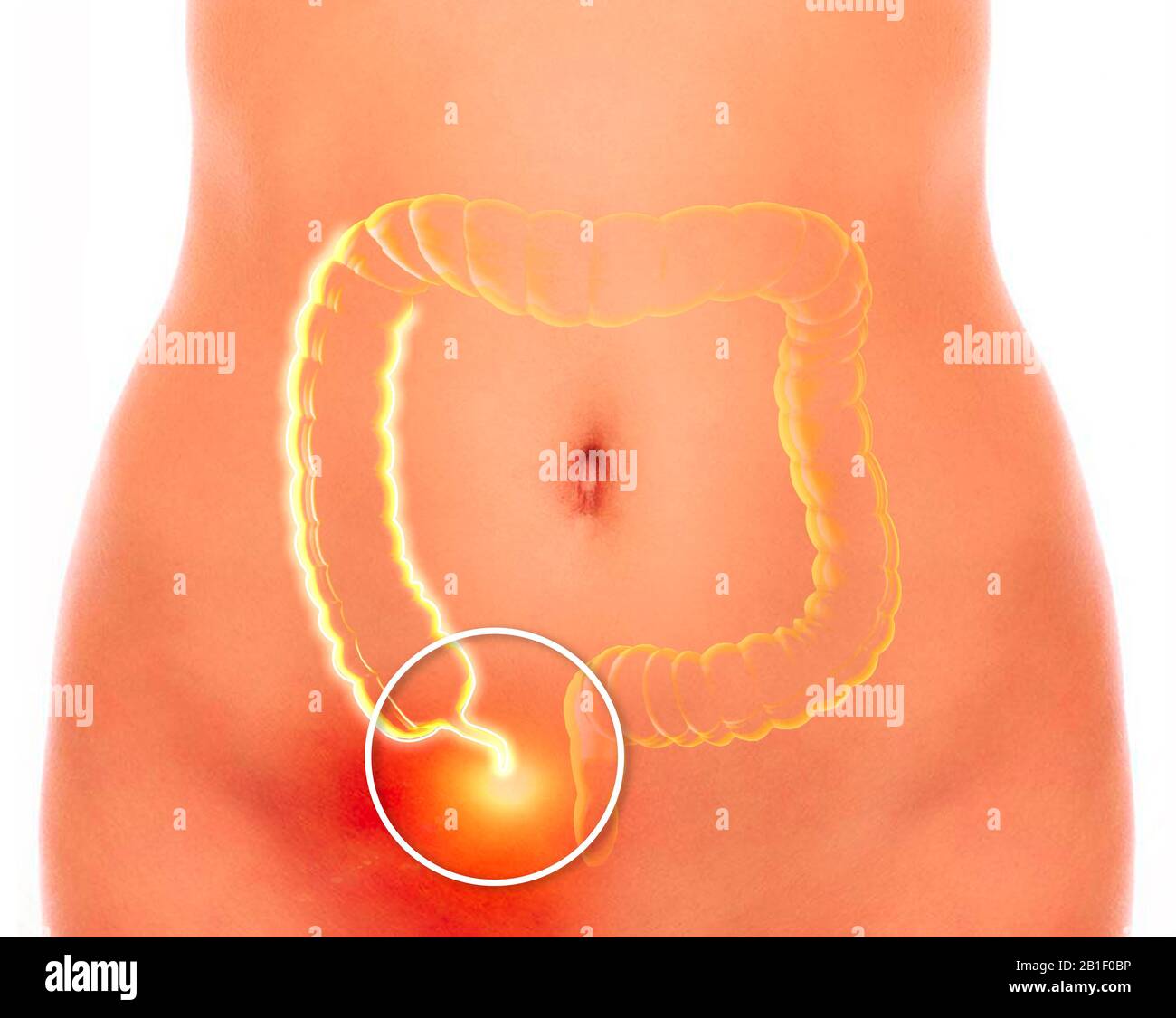 L'appendice è un tubo a estremità cieca, a forma di dito, collegato al cecum. Il cecum è una struttura del colon simile a una tasca. rendering 3d Foto Stock