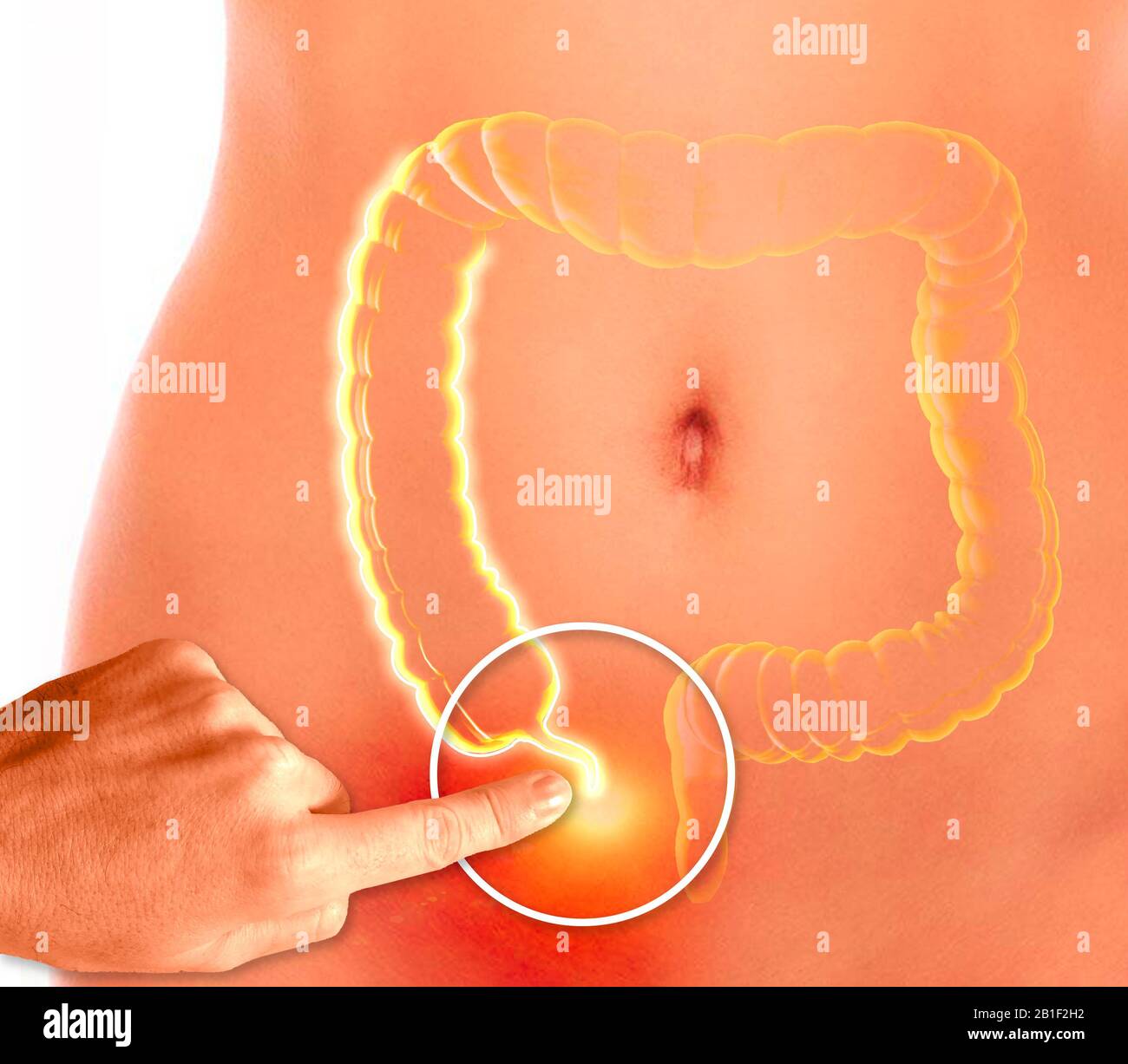 L'appendice è un tubo a estremità cieca, a forma di dito, collegato al cecum. Il cecum è una struttura del colon simile a una tasca. rendering 3d Foto Stock