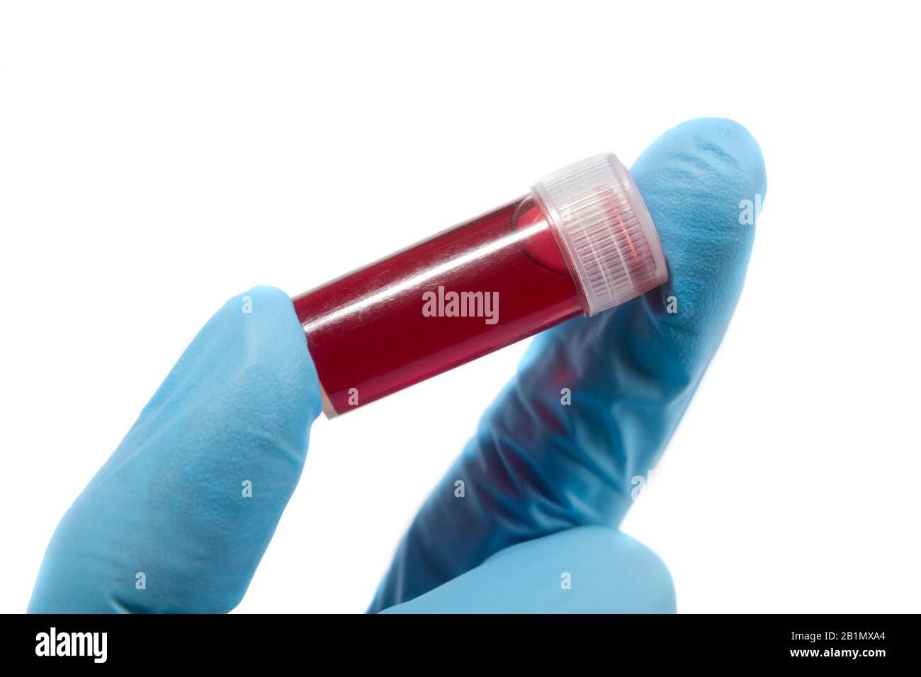 Provetta per analisi del sangue in una mano medica con guanti medici blu. Foto Stock