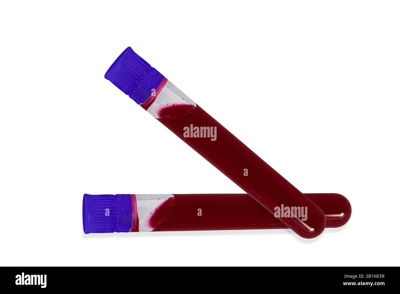 Provette per analisi del sangue in laboratorio isolate su bianco Foto Stock