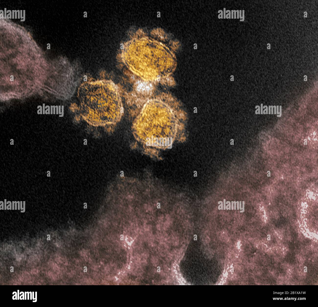 COVID-19. Nuovo Coronavirus SARS-COV-2 Questa immagine di microscopio elettronico a trasmissione mostra SARS-COV-2, il virus che causa COVID-19, isolato da un paziente nelle particelle di virus degli Stati Uniti (oggetti di oro rotondo) sono mostrati emergenti dalla superficie di cellule coltivate nel laboratorio. I picchi sul bordo esterno delle particelle di virus danno coronavirus il loro nome, corona-come. Credito: NIAID-RML Foto Stock