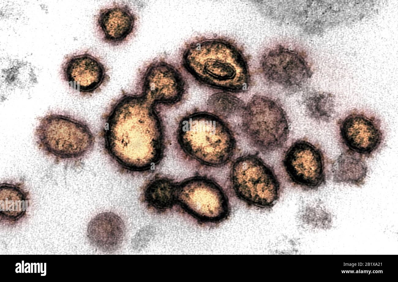 COVID-19. Nuovo Coronavirus SARS-COV-2 Questa immagine di microscopio elettronico a trasmissione mostra SARS-COV-2, il virus che causa COVID-19, isolato da un paziente nelle particelle di virus degli Stati Uniti sono mostrati emergenti dalla superficie delle cellule coltivate nel laboratorio. I picchi sul bordo esterno delle particelle di virus danno coronavirus il loro nome, corona-come. Credito: NIAID-RML Foto Stock