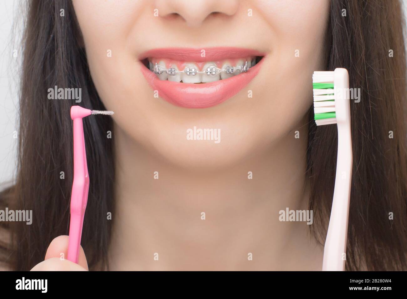 Due tipi di spazzola per la pulizia dei denti con le bretelle dentarie.  Staffe sui denti dopo l'imbianchimento. Staffe auto-leganti con fascette in  metallo e grigio Foto stock - Alamy