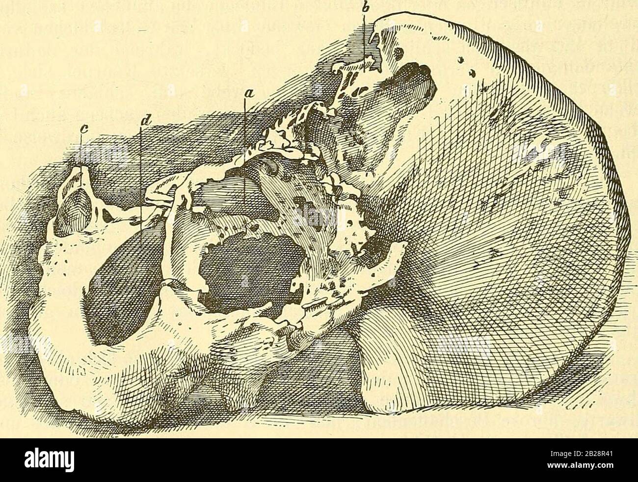 "Lehrbuch der allgemeinen patologischen anatomie und patogenese" (1887) Foto Stock