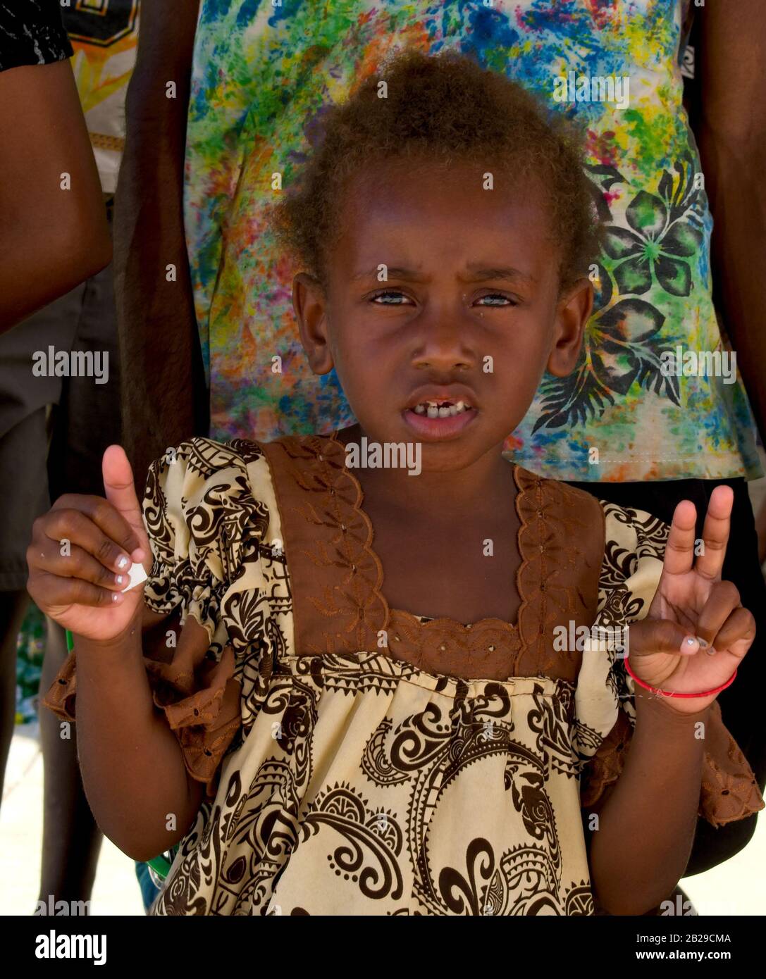 Port Vila, Vanuatu - 14 febbraio 2020: Bambina Kanak che posa per una foto. Foto Stock