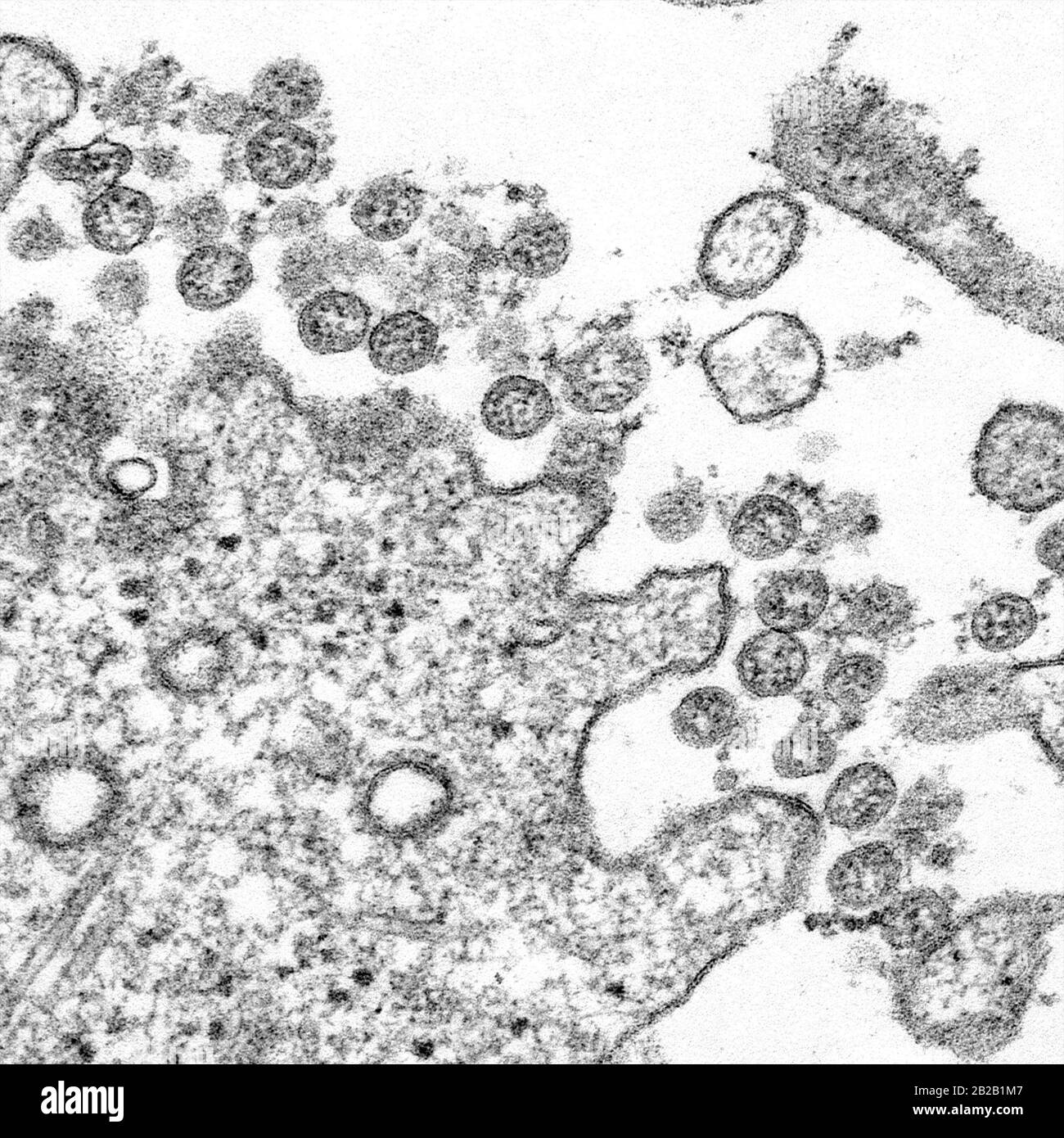 Immagine microscopica elettronica di trasmissione di un isolato dal primo caso statunitense di 2019-nCoV (Covid-19). Le particelle virali extracellulari sferiche Foto Stock