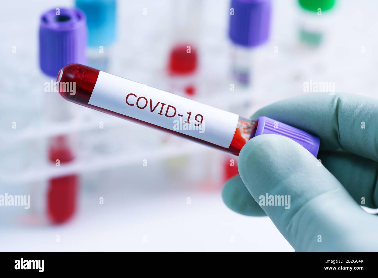 covid-19 - provetta campione con coronavirus in laboratorio Foto Stock