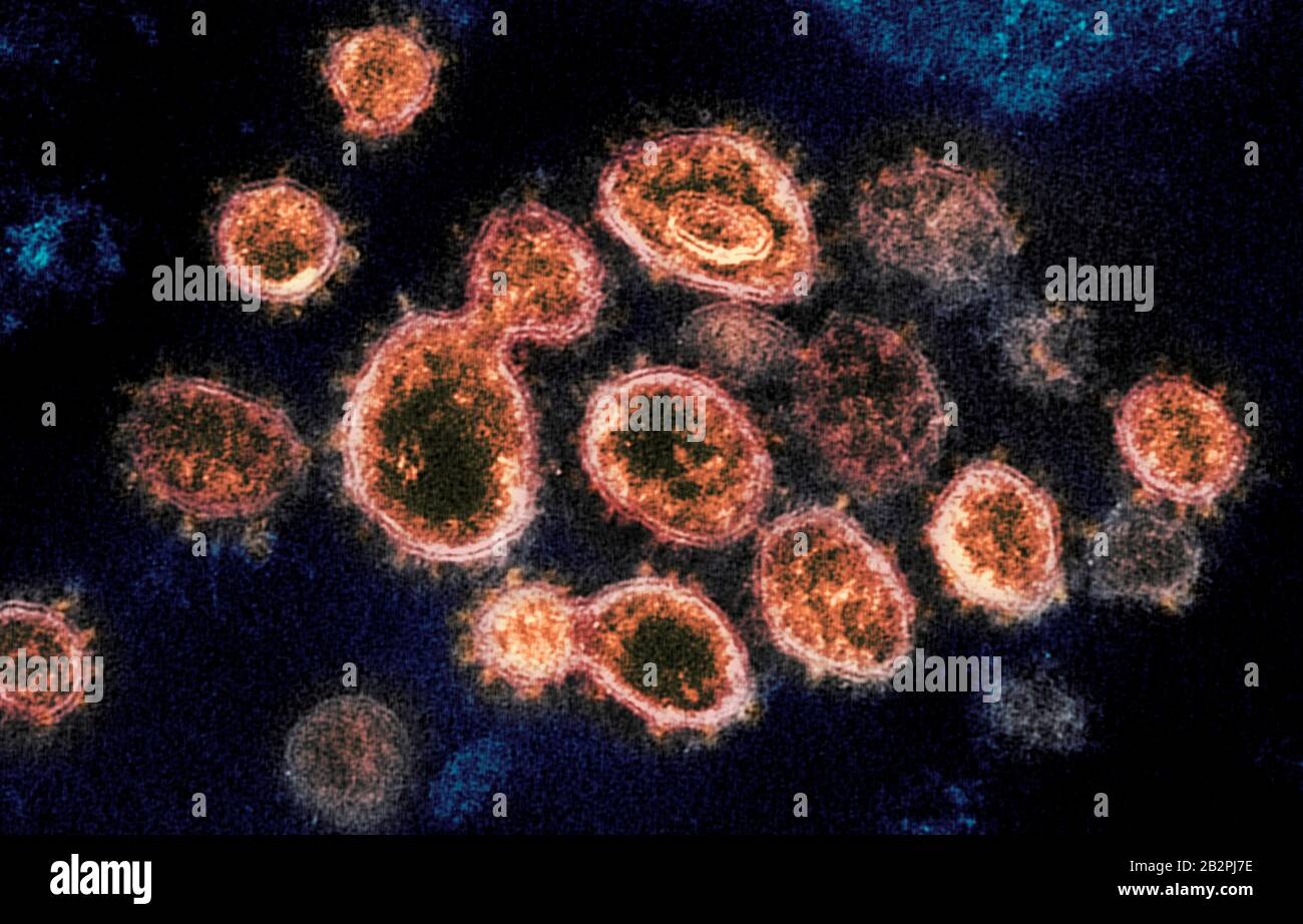 Una micrografia elettronica di trasmissione di COVID-19, nuovo coronavirus, particelle di virus, isolato da un paziente catturato e potenziato dal colore presso il Niaid Integrated Research Facility 14 febbraio 2020 a Fort Detrick, Maryland. Foto Stock