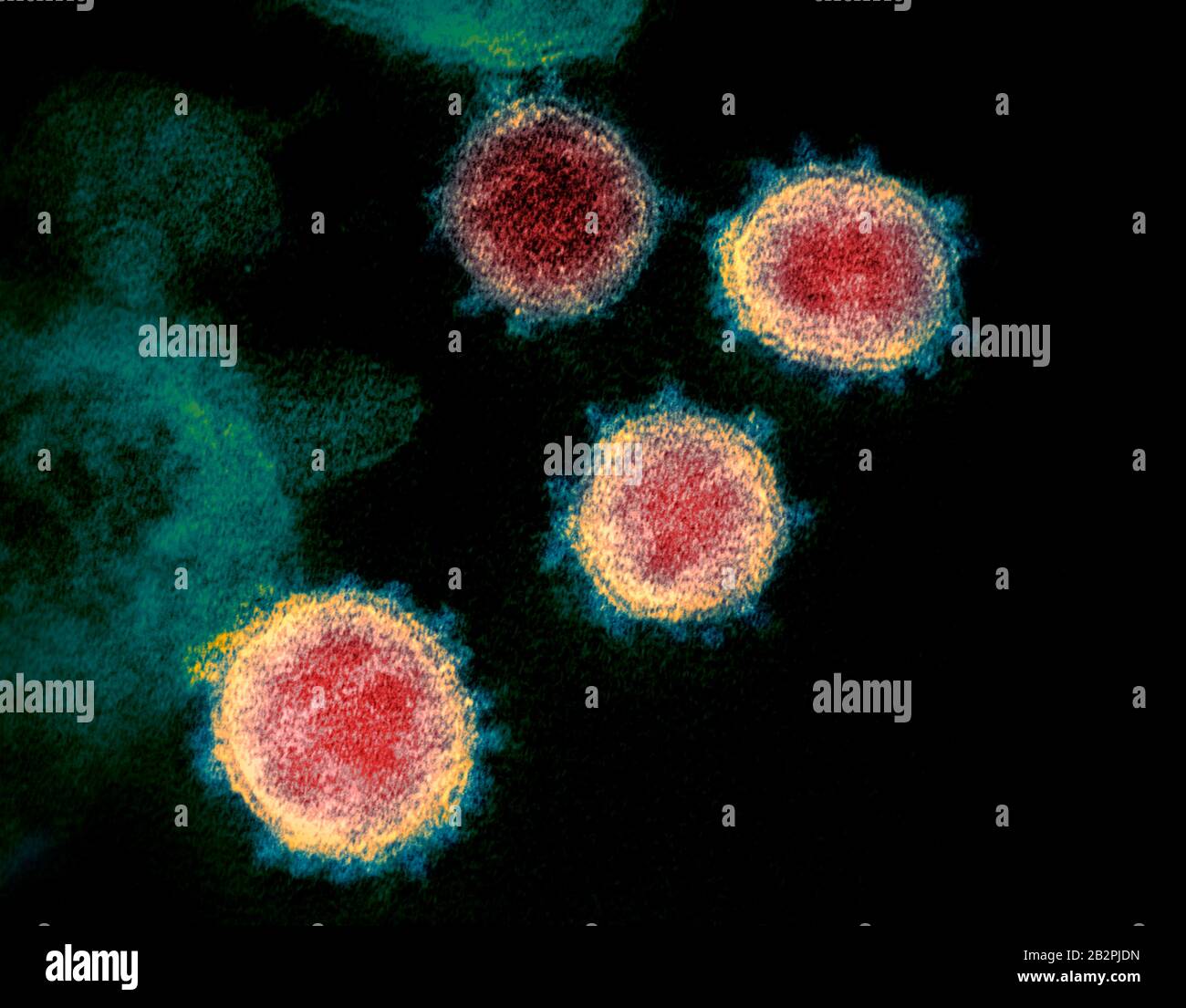 Una micrografia elettronica di trasmissione di COVID-19, nuovo coronavirus, particelle di virus, isolato da un paziente catturato e potenziato dal colore presso la Niaid Integrated Research Facility 12 febbraio 2020 a Fort Detrick, Maryland. Foto Stock