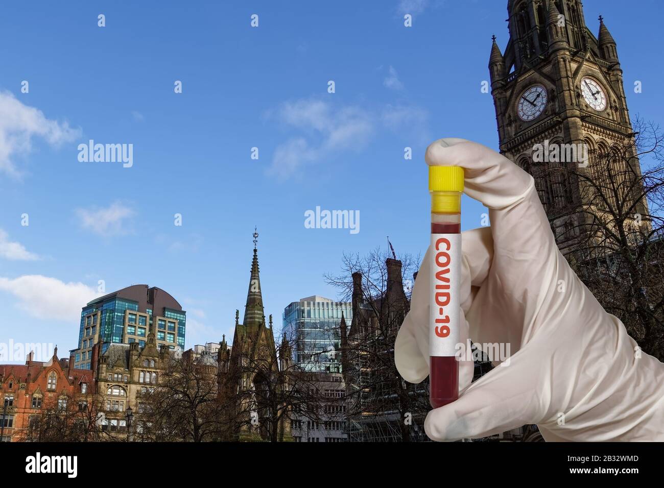 Manchester, Regno Unito Coronavirus COVID-19 World Outbreak Concept. Chimico con guanti tiene la provetta di sangue con il virus 2019-nCoV prima del Municipio di Manchester. Foto Stock
