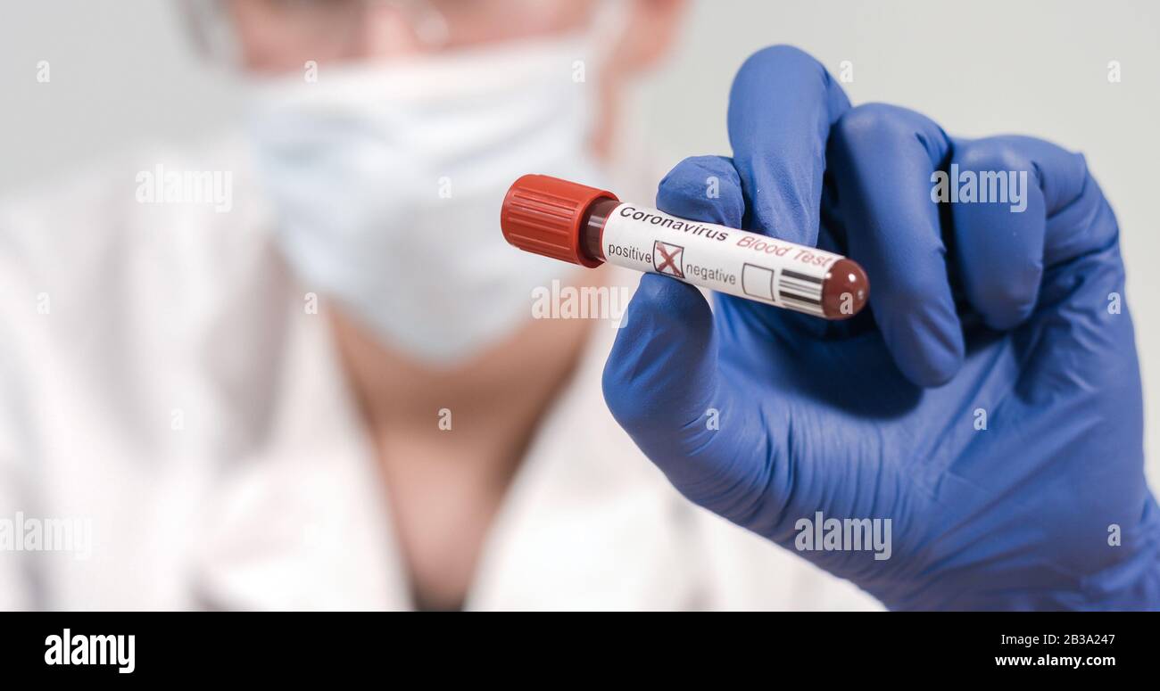 Campione Di Sangue Infetto Di Coronavirus Covid-19 Nelle Mani Di Doctor Scientist. Epidemia E Epidemia Di Virus. Foto Stock