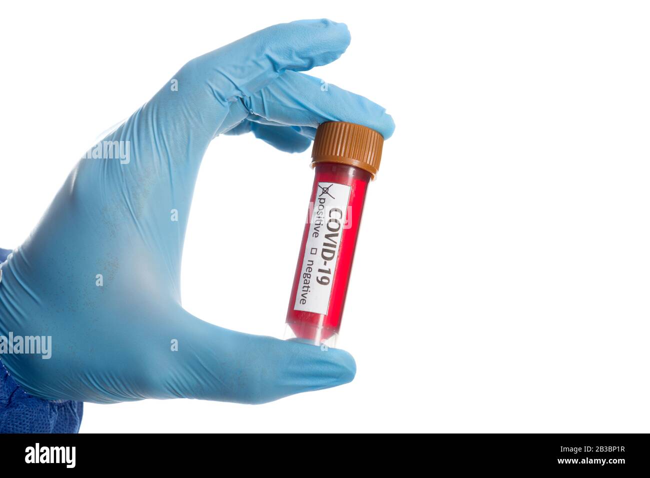 Provetta per analisi del sangue in mano al medico, Foto Stock