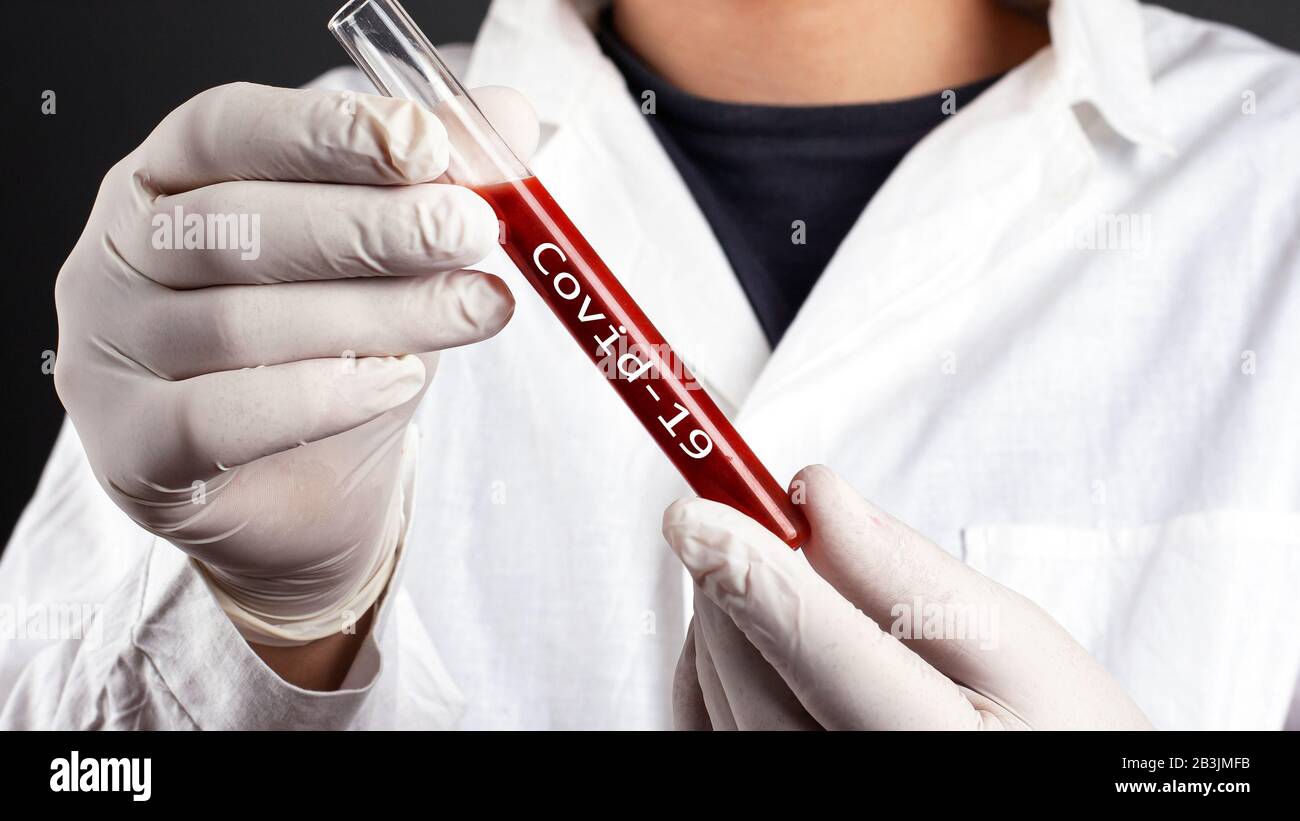 il medico tiene la provetta con il virus covid-19 infetto nel sangue. coronavirus pandemia. Foto Stock