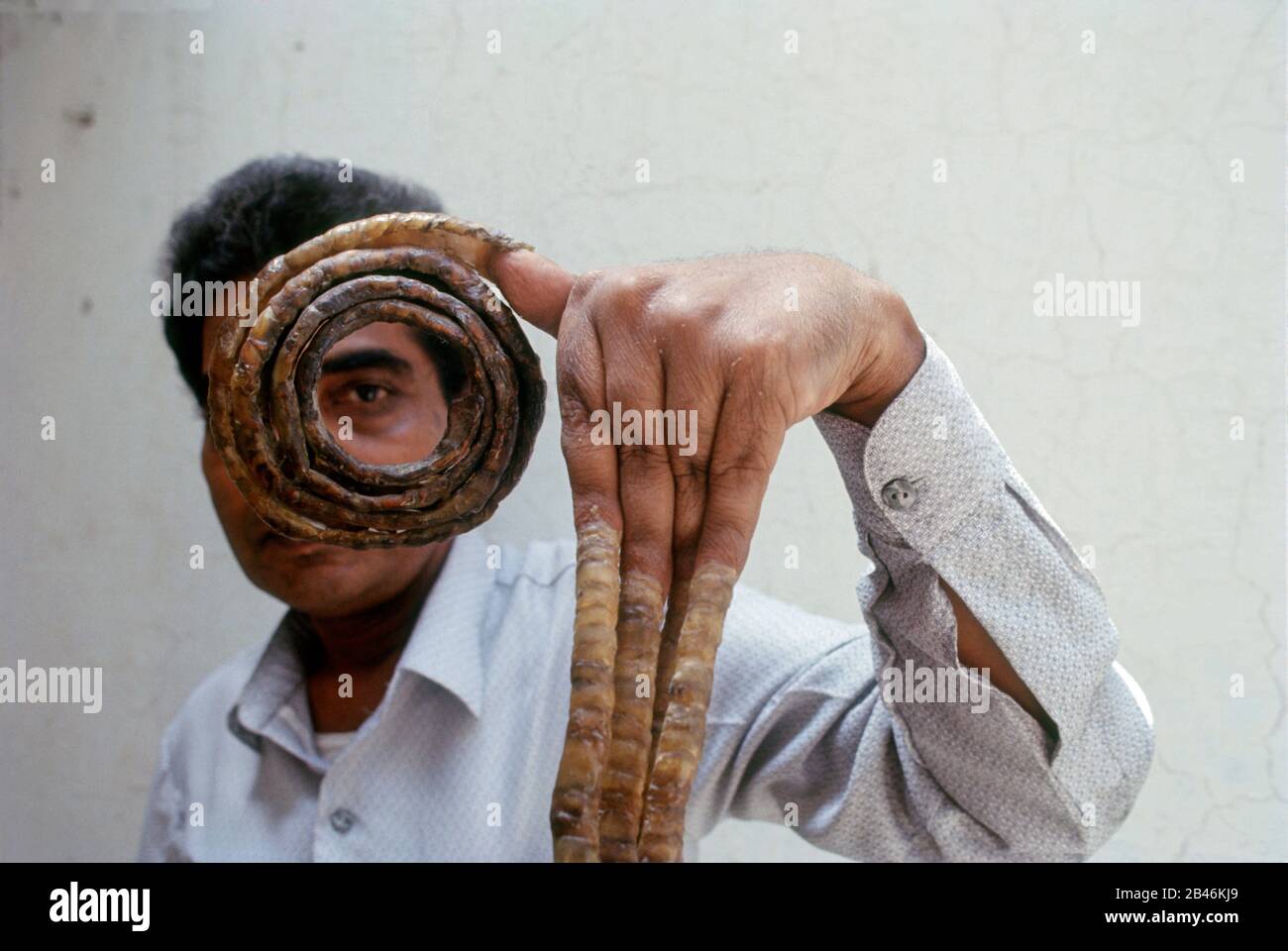 Shridhar Chillal, il più lungo record mondiale di unghie, India, Asia Foto Stock