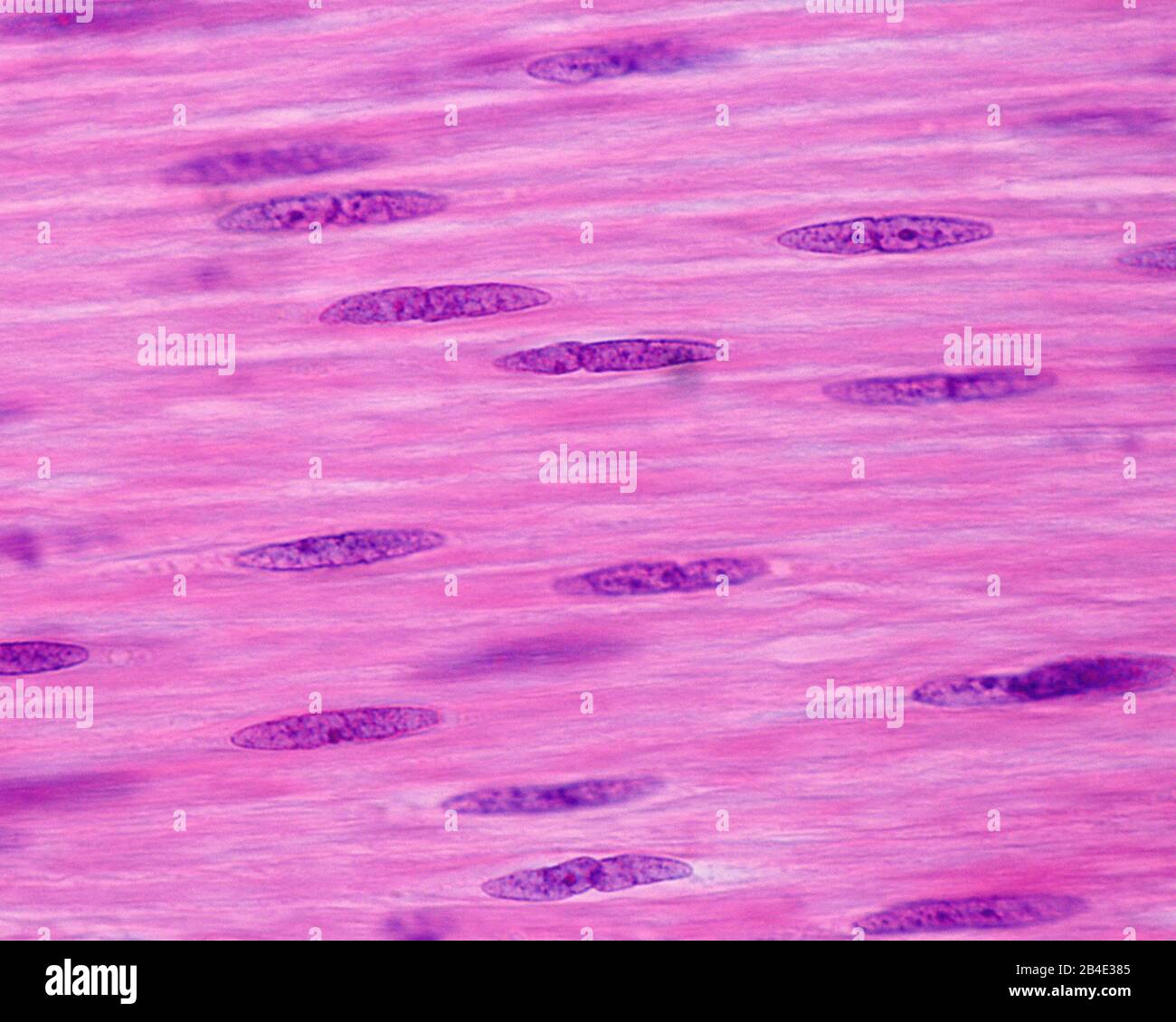 Nuclei di cellule muscolari lisce. Queste cellule mostrano un nucleo fusiforme molto allungato che contiene piccoli nucleoli. Le piccole incisioni nel nucleo su Foto Stock