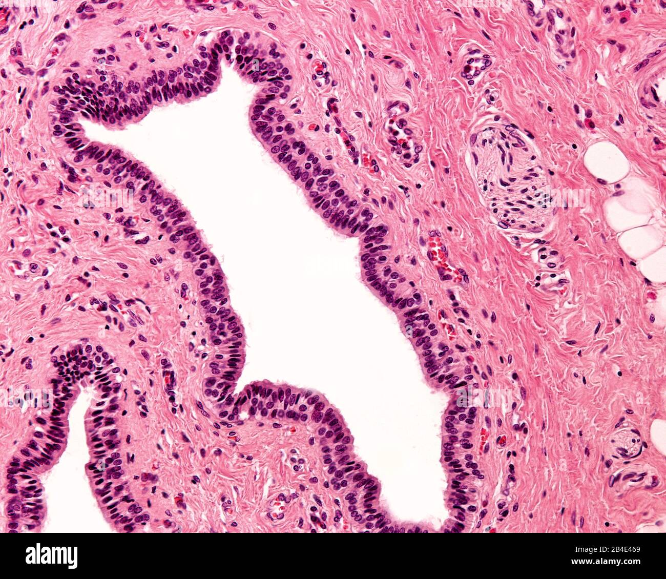 Epitelio colonnare stratificato. Si tratta di un raro tipo di epitelio composto da cellule colonnari disposte in più strati (di solito solo due). Escrementi grandi Foto Stock
