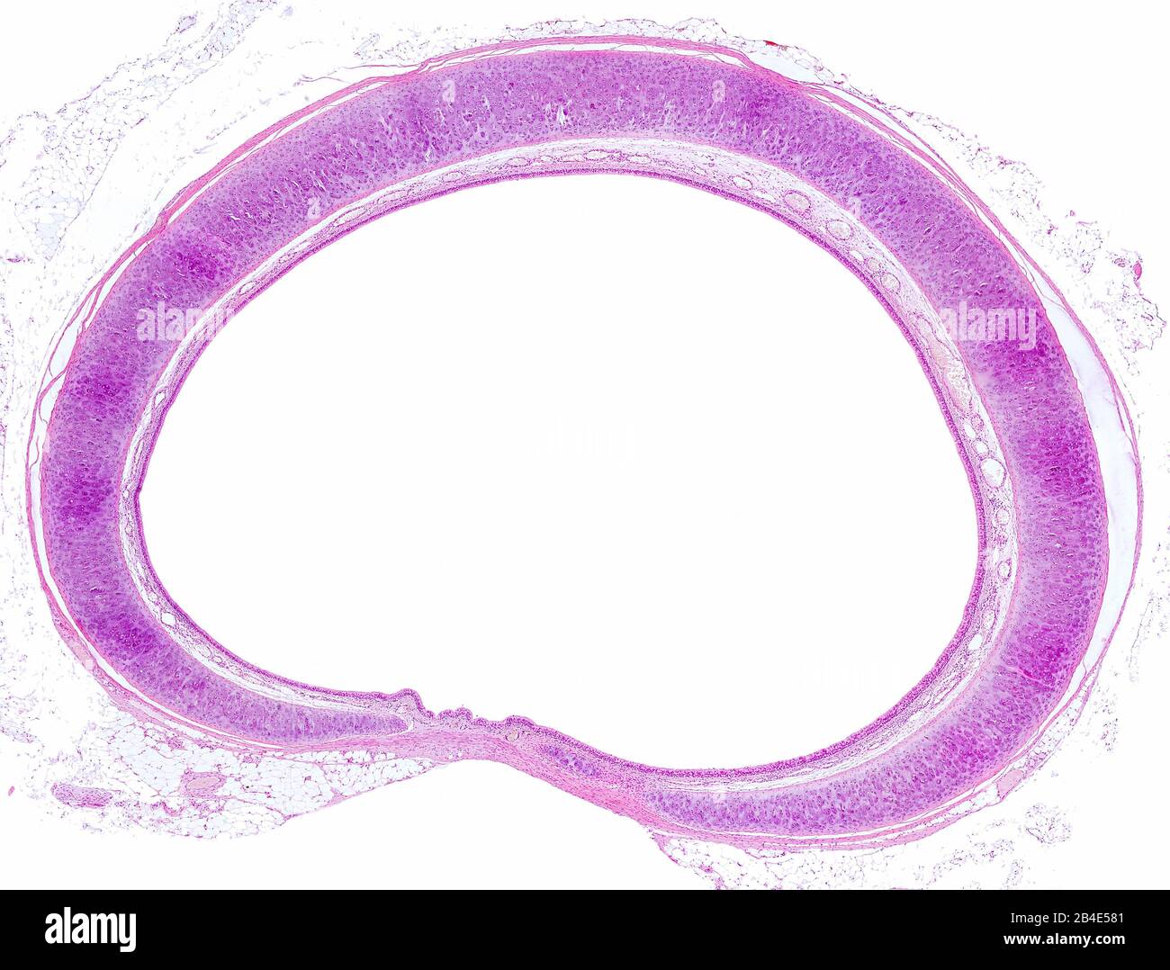 Anelli Di Cartilagine Immagini e Fotos Stock - Alamy