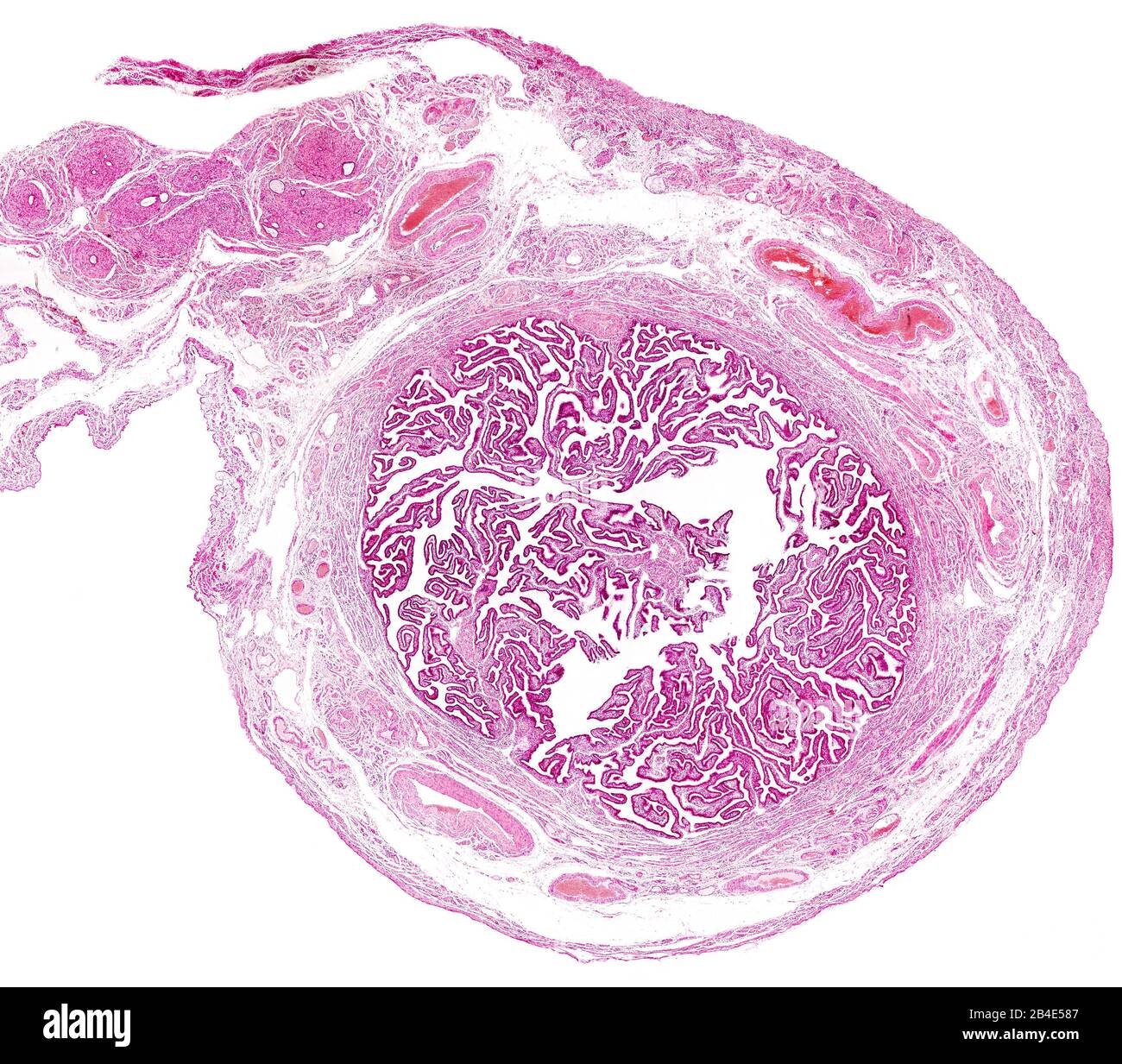 Sezione trasversale di un tubo di Falloppio umano. Lo strato più interno è una mucosa molto ripiegata. All'esterno si trovano lo strato muscolare e lo strato serosa, sho Foto Stock