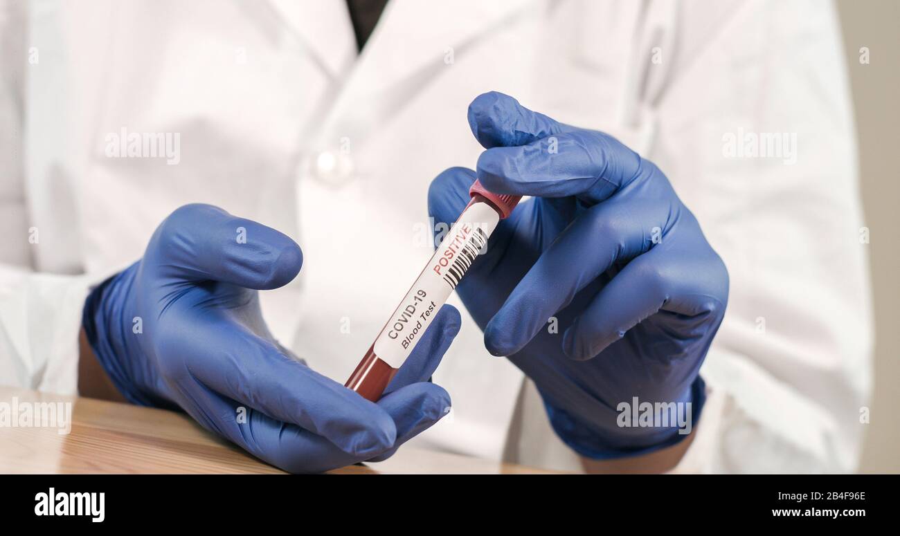 Campione Di Sangue Infetto Di Coronavirus Covid-19 Nelle Mani Di Doctor Scientist. Epidemia E Epidemia Di Virus. Foto Stock