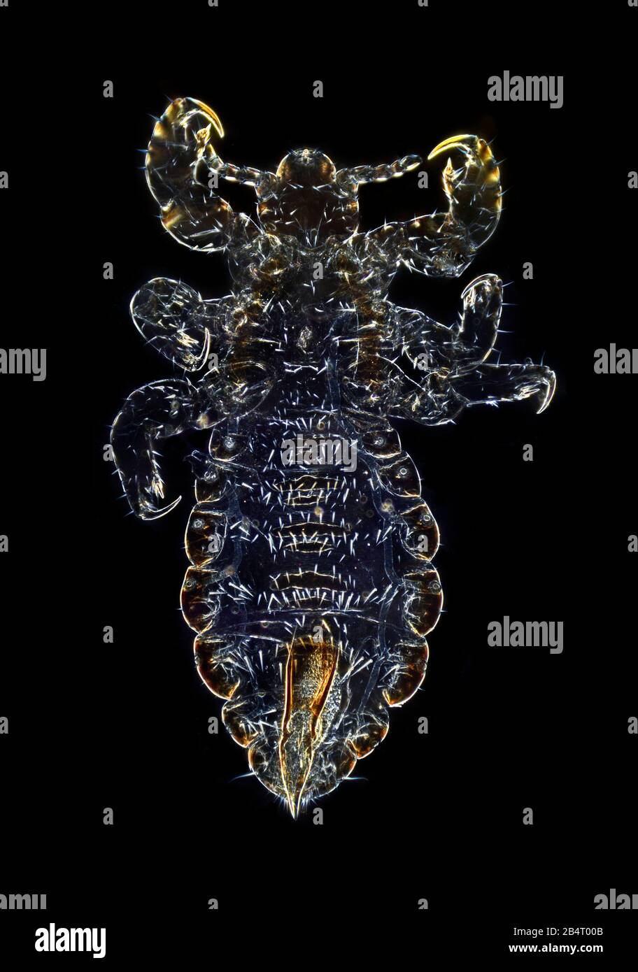 Pidocchi testa, maschio Pediculus sp., fotomicrografia dark field Foto Stock