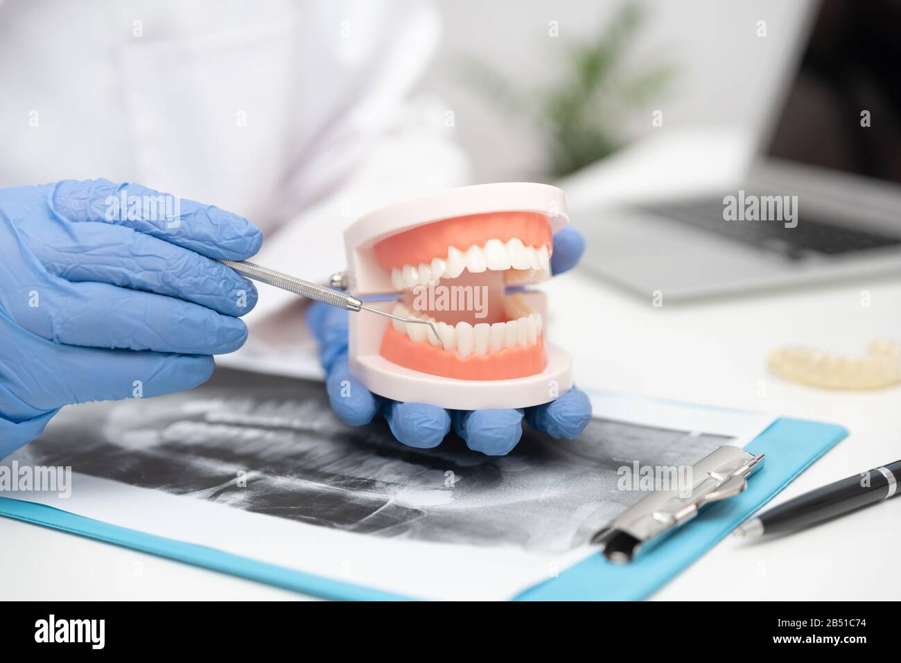 Dottore in ufficio mantiene la ganascia. Dentista mostra come prendersi cura di denti sani Foto Stock