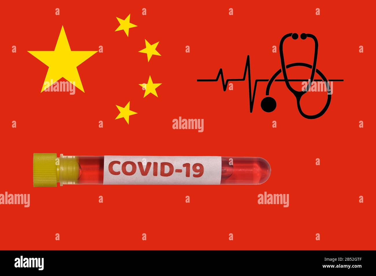 China Coronavirus COVID-19 World Outbreak Concept. Provetta Vacutainer con campione positivo per il virus 2019-nCoV prima della bandiera italiana e dello stetoscopio. Foto Stock