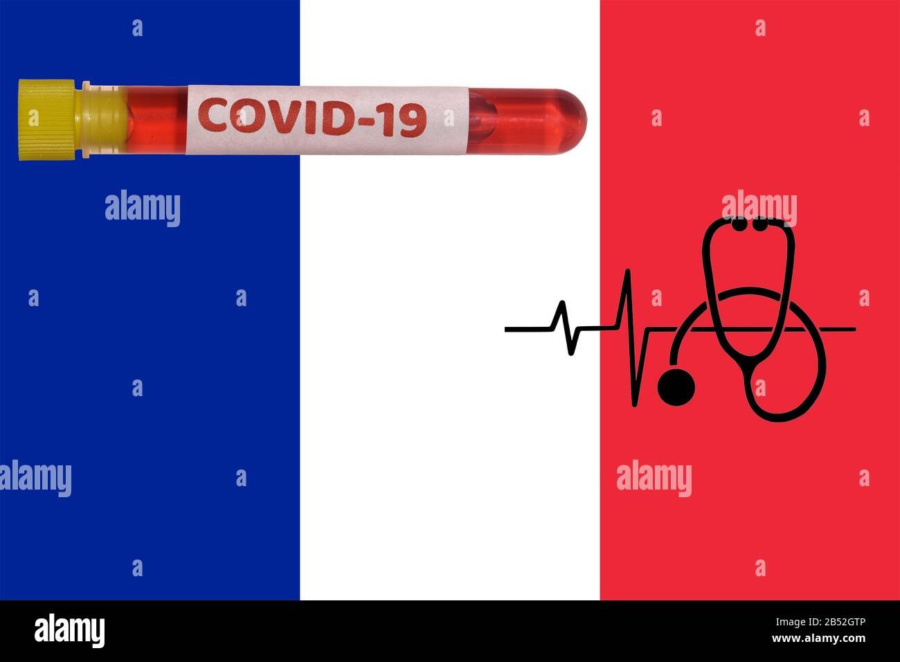 Francia Coronavirus COVID-19 World Outbreak Concept. Provetta Vacutainer con campione positivo per il virus 2019-nCoV prima della bandiera italiana e dello stetoscopio. Foto Stock