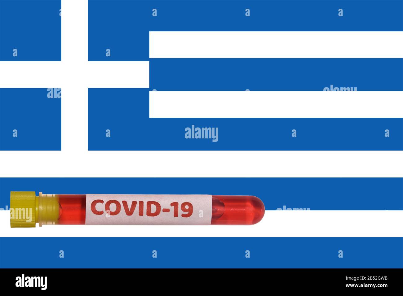 Grecia Coronavirus COVID-19 World Outbreak Concept. Provetta Vacutainer con campione positivo per il virus 2019-nCoV prima della bandiera greca. Foto Stock