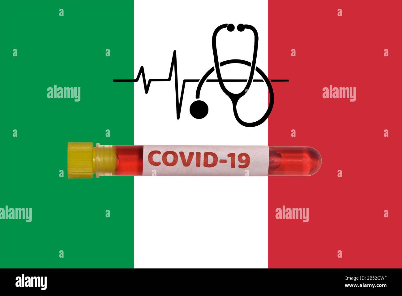Italia Coronavirus COVID-19 World Outbreak Concept. Provetta Vacutainer con campione positivo per il virus 2019-nCoV prima della bandiera italiana e dello stetoscopio. Foto Stock